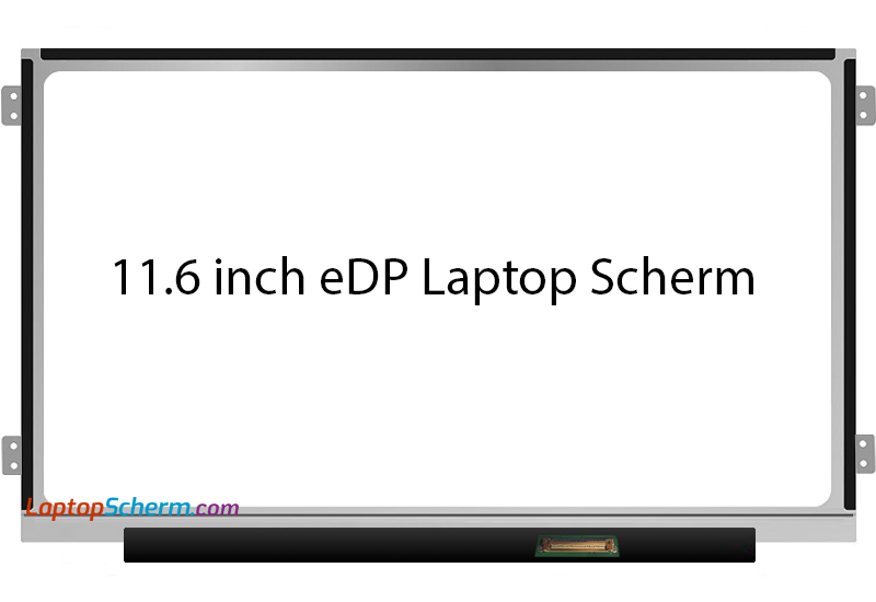 11.6 inch eDP LaptopScherm Links-Rechts Beugels